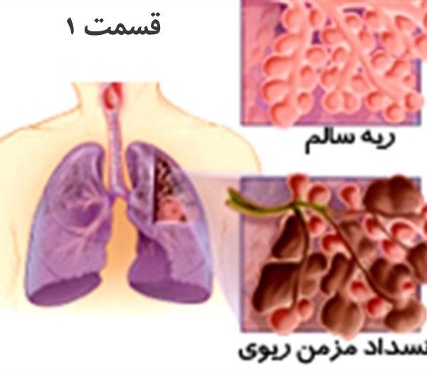 بیماری های انسدادی ریه (قسمت ۱)