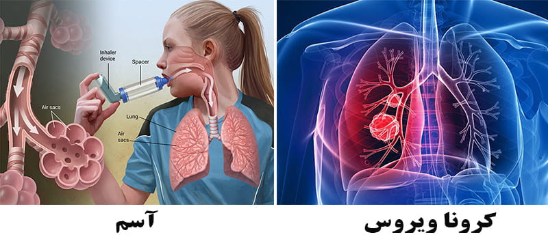 مقایسه آسیب‌های آسم و کرونا ویروس به ریه