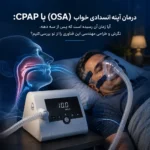 درمان آپنه انسدادی خواب (OSA) با CPAP